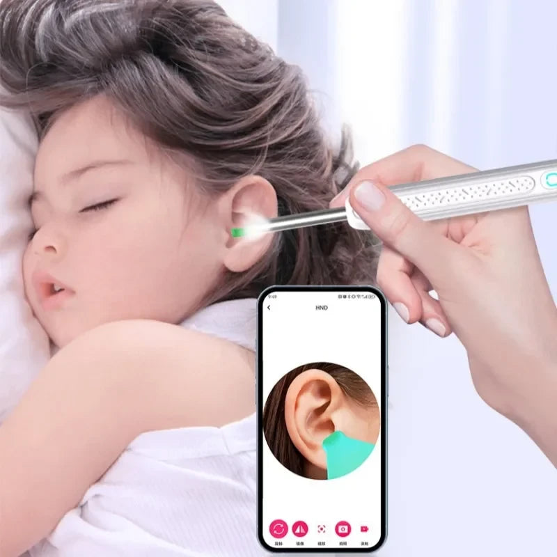 Otoscopio Inteligente con Cámara