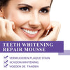Tratamiento Para Blanqueamiento Dental