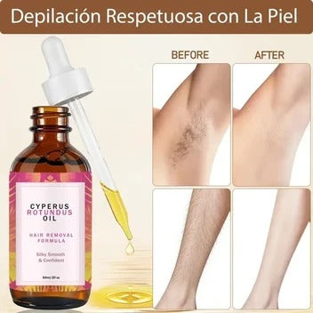 Cyperus Rotundus - Tratamiento Eliminador de Vello